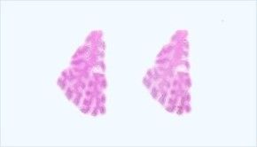 Frozen Tissue Section - Human Adult Normal: Heart: Interventricular Septum