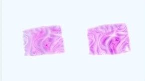 Paraffin Tissue Section - Human Adult Normal: Brain: Cerebral Meninges